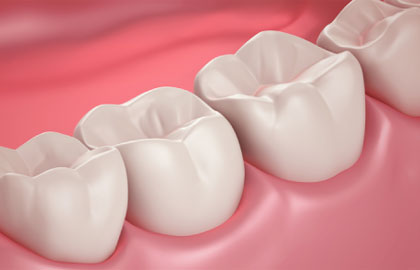 Endodontic therapy